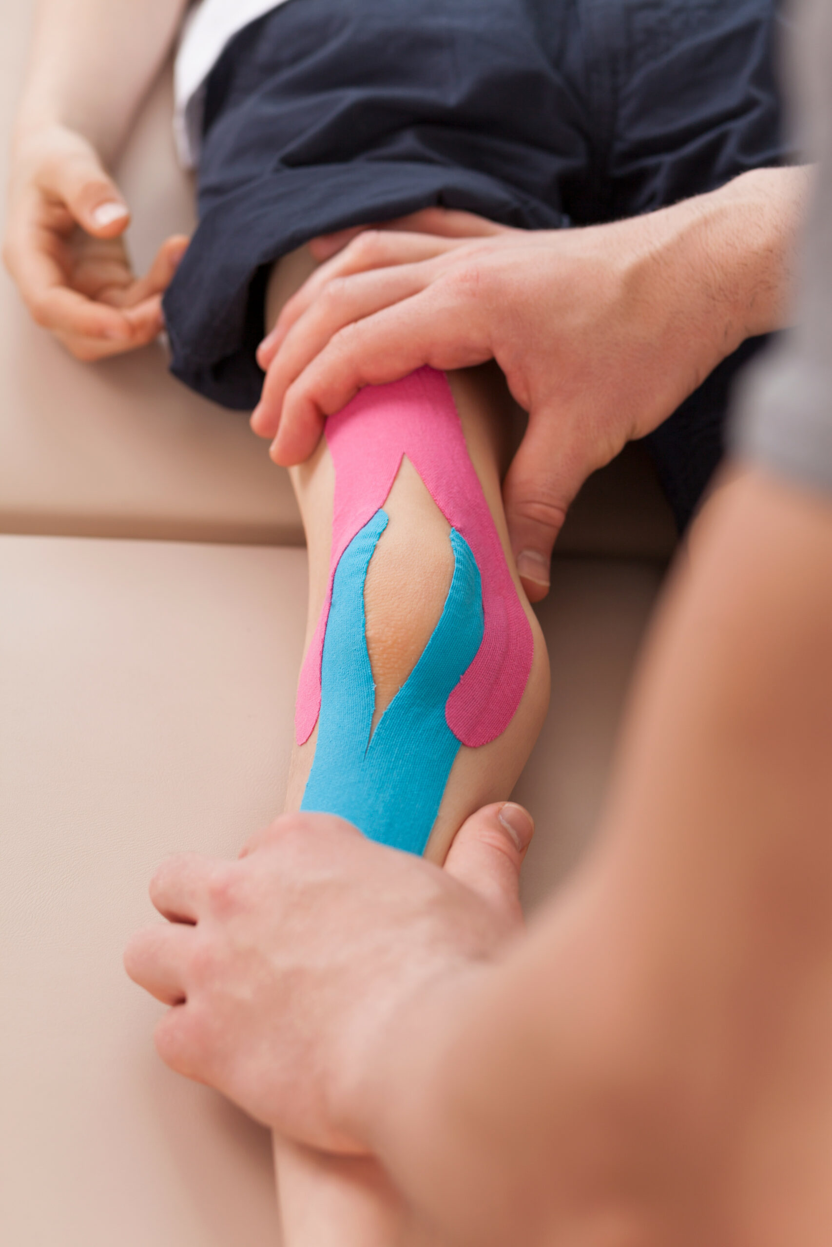 Child with knee valgus having applied kinesio tapes
